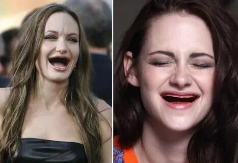 Celebrities Without Teeth