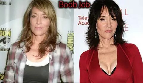 Katey Sagal Plastic Surgery - Plastic Industry In The World