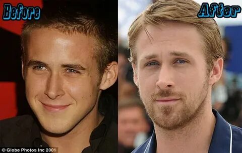 Ryan Gosling Plastic Surgery tarafashiondesigners