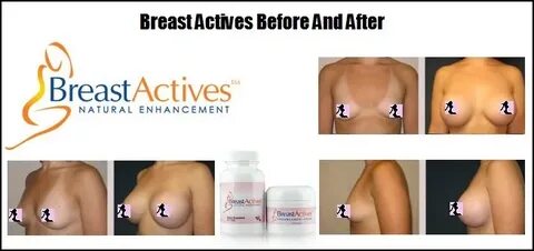 Breast Actives Reviews Natural Breast Enhancement