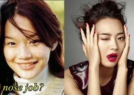 Shin Min Ah Plastic Surgery Before and After Picture - Plast