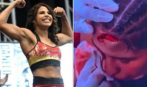 Boxer Marlen Esparza left with nasty gash on forehead during