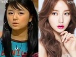 Yoon Eun Hye Plastic Surgery - With Before And After Photos