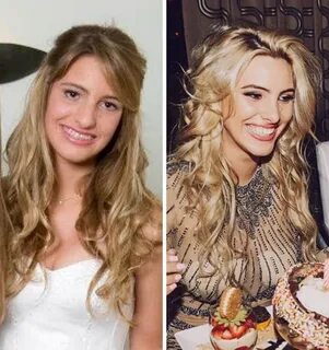 Increíble! El antes y después de la venezolana Lele Pons (+f