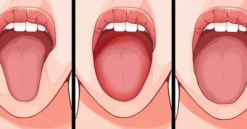 Beware, your tongue is warning you of these 5 health problem