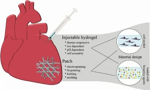 Biomaterials for cardiac applications. Injectable hydrogels 