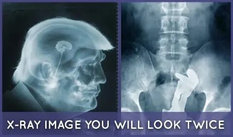 15 X-ray Images Which Will Make You Look Twice. #images #pic