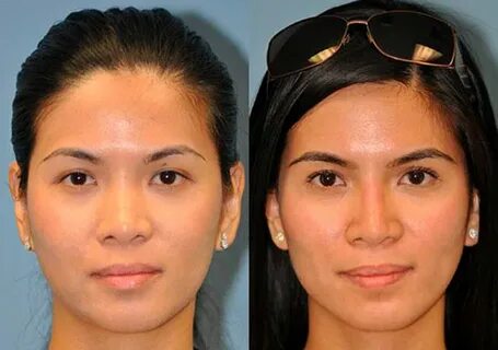 Useless Cosmetic Procedures Cosmetics# - Geniusbeauty