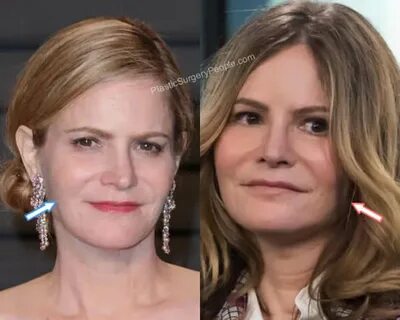 Jennifer Jason Leigh: BEFORE and AFTER 2021