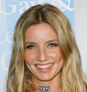 Annabelle Wallis nose job 2009 - Latest Plastic Surgery Goss