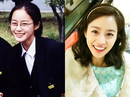 Kim Tae Hee Plastic Surgery Before and After Photos - Star P