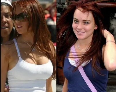 Lindsay Lohan Breast Implants