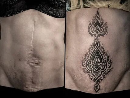 Перекрытие шрамов татуировками - tatufoto.com