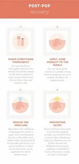 Everythying You Need to Know about Popping Pimples Acne skin