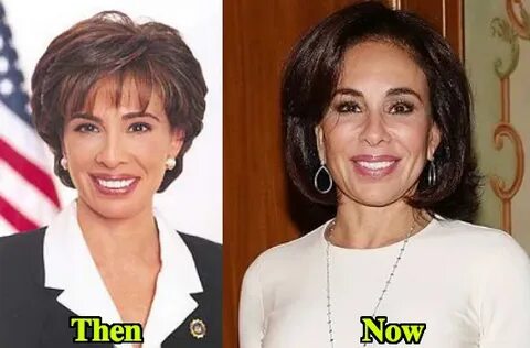 Jeanine Pirro plastic surgery achieves wonderful results - P