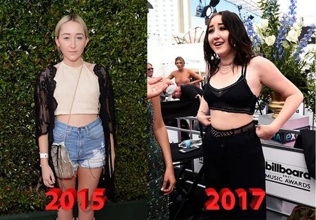 Noah Cyrus Plastic Surgery: Singer Turns into Muppet