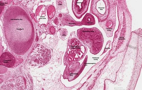 Testis Labeled - Floss Papers