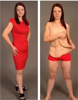 Naked before and after weightloss - Pic Porn