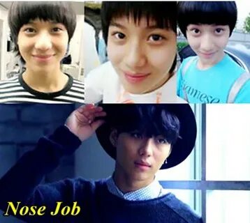 Lee Taemin Shinee Plastic Surgery Before and After - Plastic