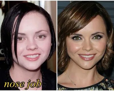 Christina Ricci Nose Job Plastic Surgery Before And After Ph