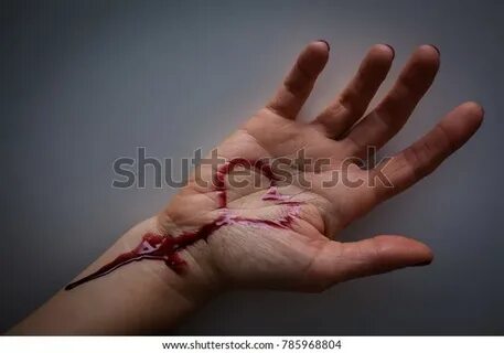 Стоковая фотография 785968804: Hand Full Blood Wrist Cut Sui