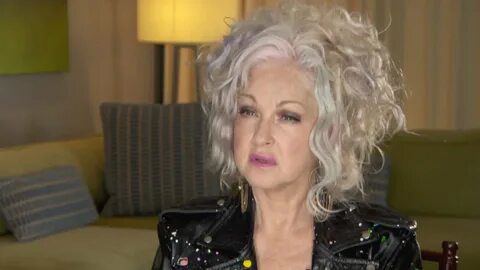 How Cyndi Lauper Found Relief from Skin Condition Inside Edi