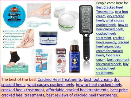 Buy best foot creams for cracked feet OFF-60