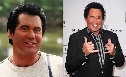 Wayne Newton Plastic Surgery