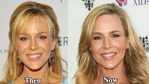 Julie Benz Plastic Surgery Before and After Photos - Latest 