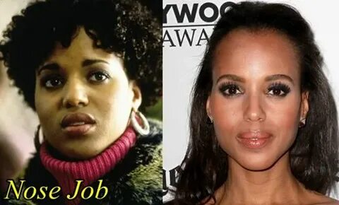 Kerry Washington Plastic Surgery Before and After Nose Job -