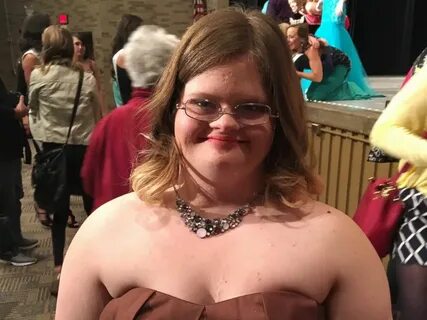 19++ Down Syndrome Woman Big Boobs Vulgar Porn Pics