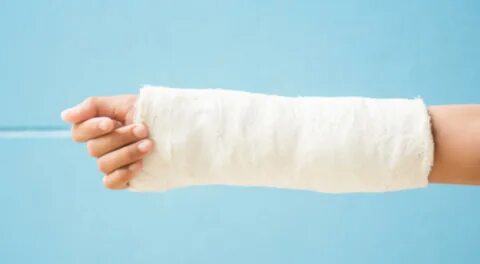 Bone Fracture Lawyer Images - Fracture