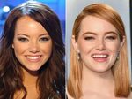 Did Emma Stone Get Plastic Surgery Including Nose Job and Bo
