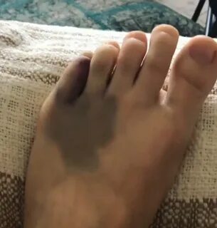 Emily Berthold's Feet wikiFeet