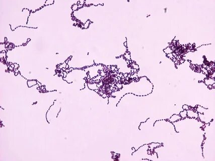 Streptococcus Pyogenes Throat - Фото база