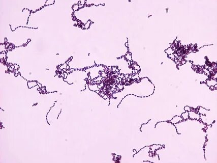 Streptococcus pyogenes; bacterial pharyngitis. Gram positive