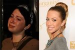 How Real Is PumpRules—Stassi Schroeder Plastic Surgery Exege
