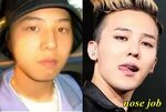 Big Bang Member, G-Dragon Plastic Surgery - Plastic Surgery 
