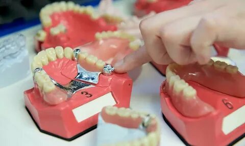 Зубные протезы: особенности, плюсы и минусы, сравнение с зуб