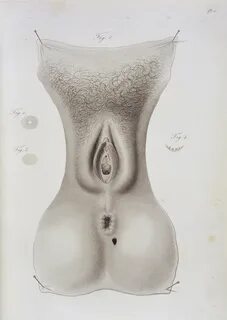 File:Vagina, perineum and anus Wellcome L0033439.jpg - Wikim