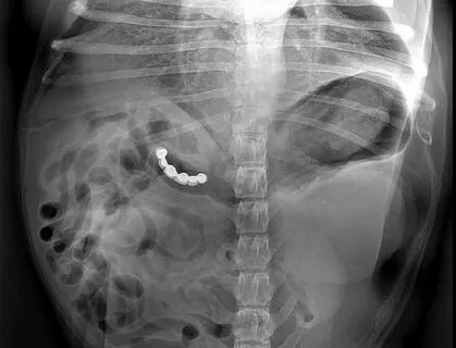 Funny X-ray Images: 30 Of The Most Unbelievably Weird X-rays