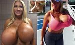 Woman who self-inflated her own boob implants is left with e