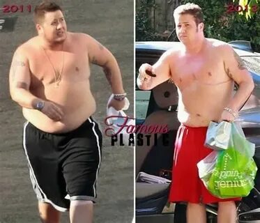 Chaz Bono Plastic Surgery Before And After Weight Loss Free 
