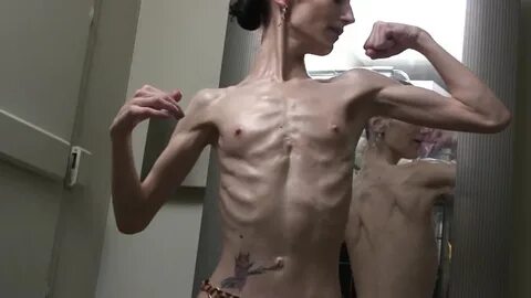 More Anorexics - Didn't feel like sorting MOTHERLESS.COM ™