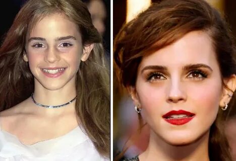 Did Emma Watson Have Implants? Let's have a look! - Verge Ca