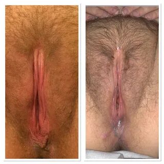 pussy before and after