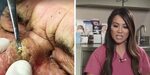 34+ The Nose Knows Part 2 Mr Wilsons Blackhead Extractions I