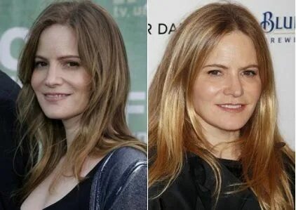 Jennifer Jason Leigh Plastic Surgery Before and After - Cele