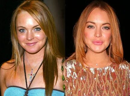 Photos from Celebs Who Deny Getting Plastic Surgery - E! Onl