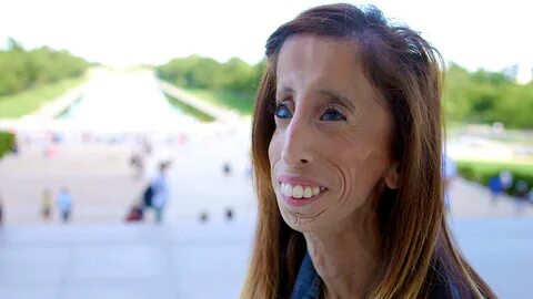 Lizzie Velasquez: "Ugliest woman' video changed my life for 